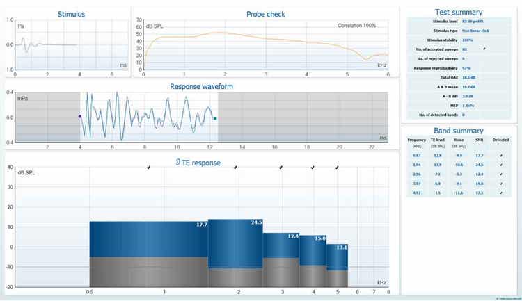 TEOAE software screen, showing stimulus, probe check, response waveform, TE response, test summary, and band summary.