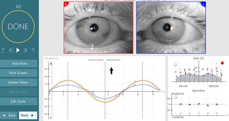 Eye tracking software displaying separate eye disorders