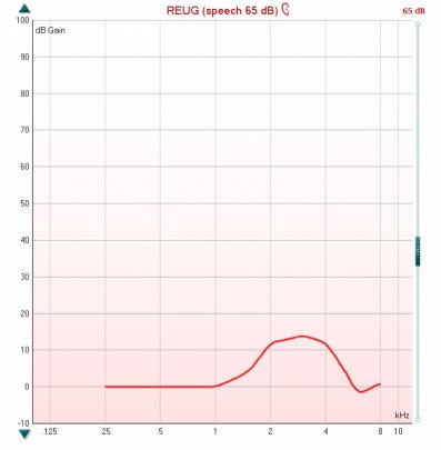 Real-ear-unaided-gain curve with kHz as a function of dB Gain. The curve peaks at 3 kHz with a value of just below 15 dB Gain. It dips just below 0 dB Gain at 6 kHz and then recovers.