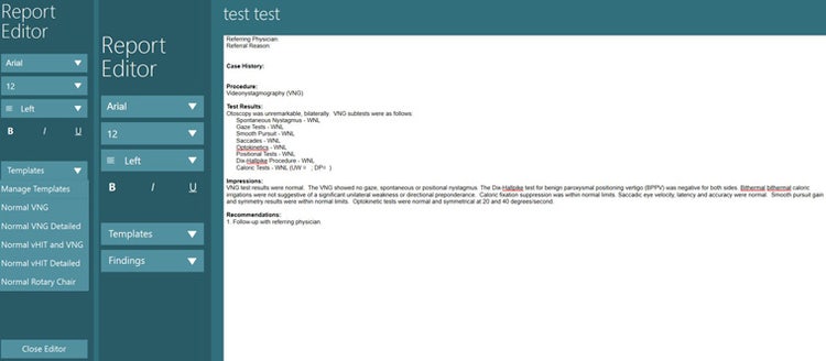 Upon clicking on the templates drop-down menu, this example shows the following available templates: normal VNG, normal VNG detailed, normal vHIT and VNG, normal vHIT detailed, and normal rotary chair. The normal VNG template is also shown, including the following details: referring physician, referral reason, case history, procedure, test results, impressions, and recommendations. Test results are listed for otoscopy and all the VNG sub-tests, including: spontaneous nystagmus, gaze tests, smooth pursuit, saccades, optokinetics, positional tests, Dix-Hallpike procedure, and caloric tests.