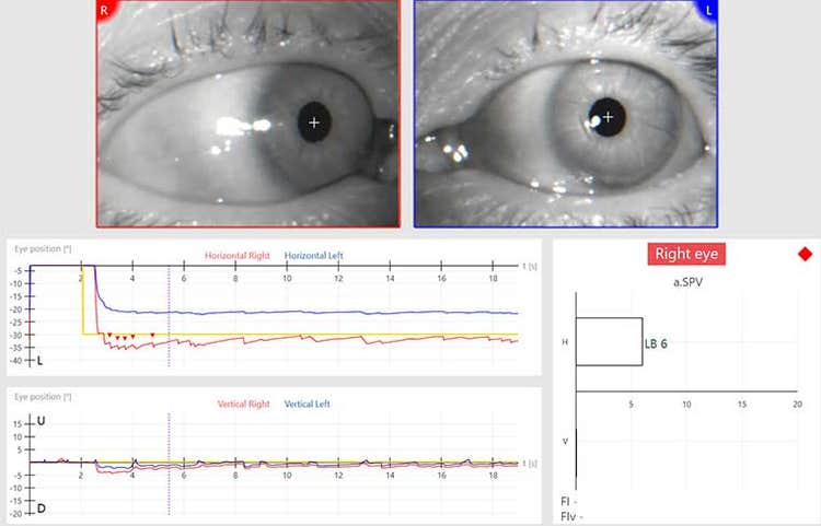 Eye tracking software displaying separate eye movement