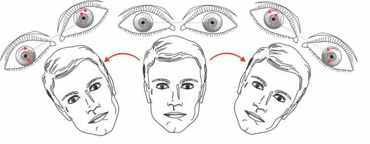 Three heads displaying eye movements when the head is tilted to the left, head upright, and head tilted to the right.