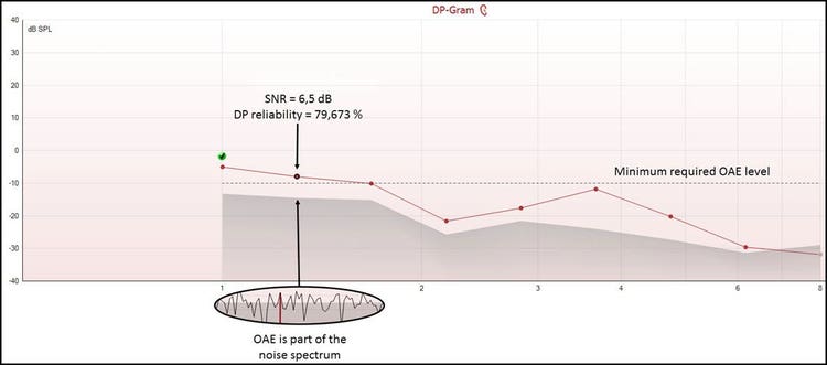 DPOAE response with a six point five dB SNR and a reliability of 79 percent