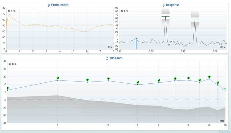 DPOAE software screen, showing probe check, DPOAE response, and DP-Gram.