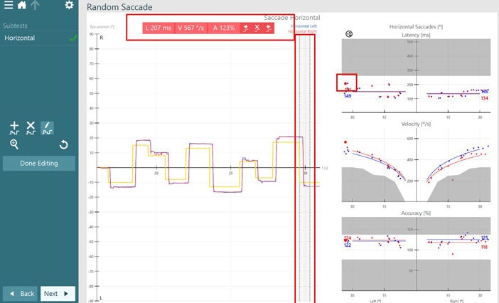 Results overview for horizontal saccade test. Red and blue curves for right and left eye movements follow the yellow curve for target position smoothly and quickly. Graphs for latency, velocity, and accuracy indicate normal results, with results located in the white, normal regions, and not in the grey, abnormal regions. The user has selected a data point with a latency of 207 milliseconds, a velocity of 567 degrees per second, and an accuracy of 123 %. In the velocity graph, it appears as an outlier.