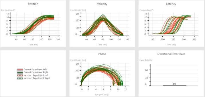 Position, velocity, latency, phase, and directional error rate all appear normal for both eyes.