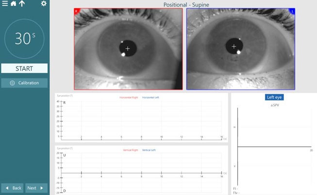 Supine positional test screen. The patient’s eyes are open and ready for recording.