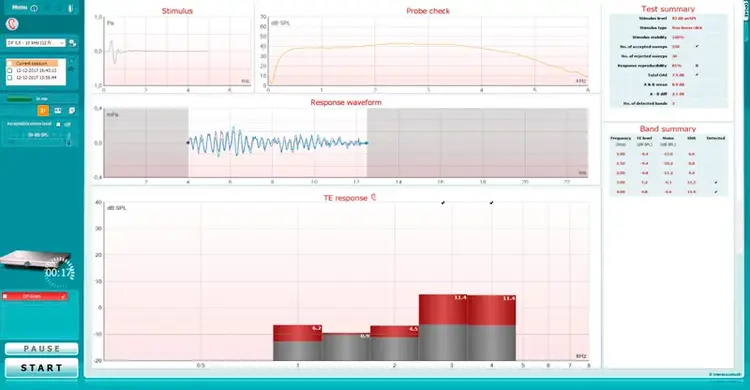 TEOAE software screen