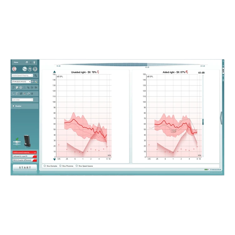Laptop with visible speech mapping software.