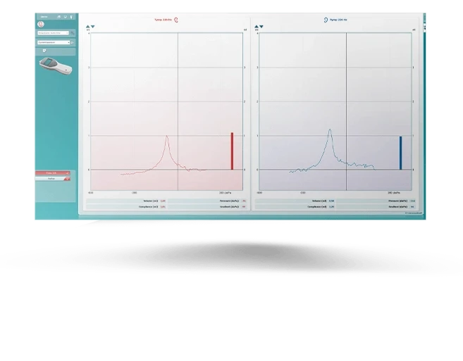 226 Hz tympanograms displayed in MT10 software