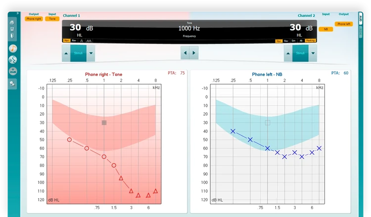 Pure tone audiograms