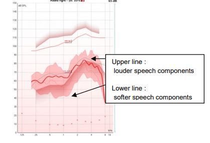 Aided measurement that displays thresholds above softer speech components, but below louder speech components.