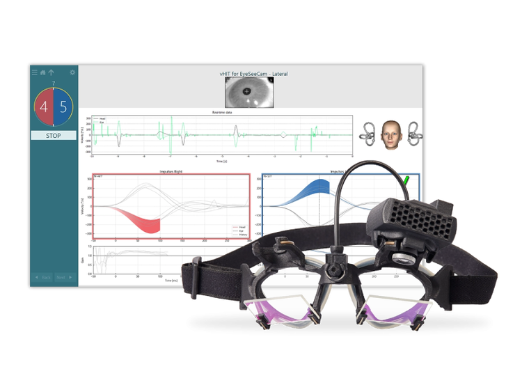 EyeSeeCam video head impulse test goggles
