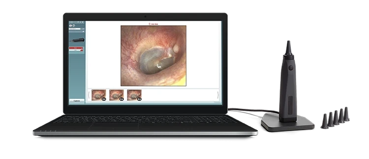 Laptop with video otoscopy software, Viot™ and speculums.