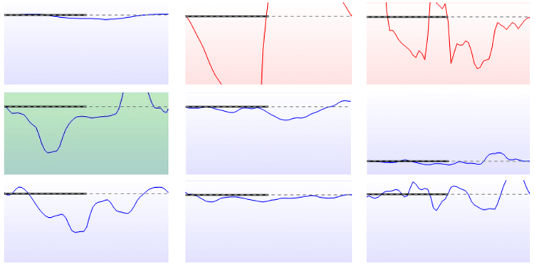 Nine different, non acoustic reflexes. Some have deflection values that are too small, and some are all over place, moving up and down and crossing the x-axis.
